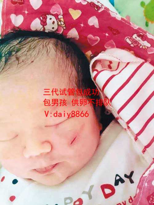 北京借卵生男孩_郴州南院二代试管婴儿成功率值得信赖吗？手术有什么