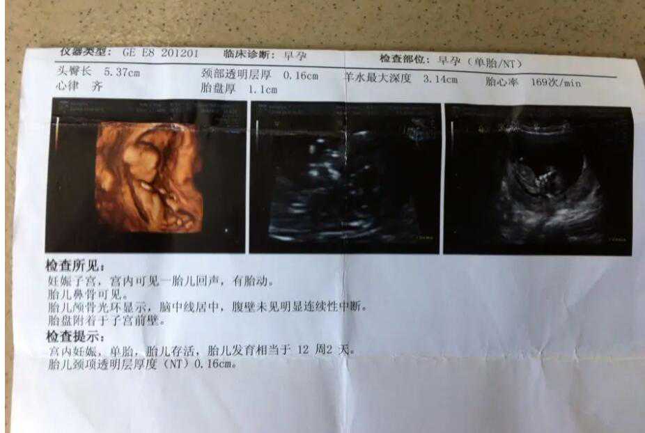 在北京想找代孕女人 北京试管婴儿十大医院 ‘怀孕37周怀女孩有什么症状’