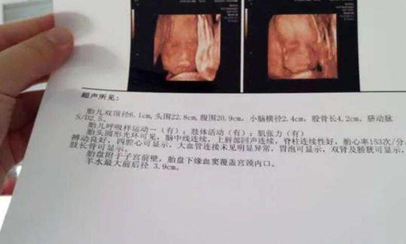 北京专业供卵机构电话 北京协和医院试管成功率 ‘孕囊三个数值看男女’